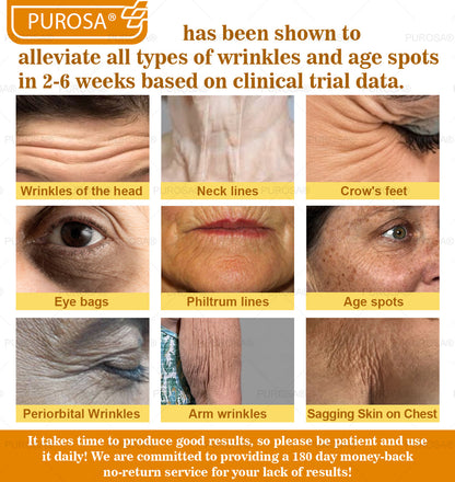 PUROSA®--One last chance! Grab this lucky find at 50% OFF!🔥180-day money back guarantee! Free air shipping!