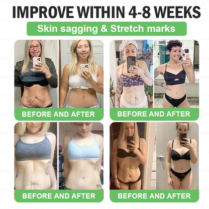 Buildleaf® 🎁Only 10 boxes! Grab an exclusive 30% discount now!Don’t miss your chance—this offer won’t come around again until next year. Act fast! 180-day money back guarantee!