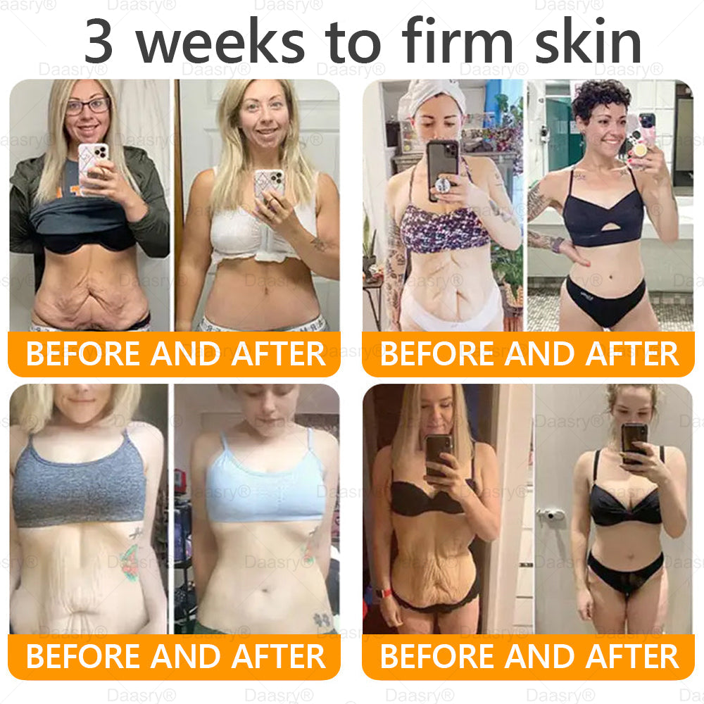 TGA Official: Daasry® Bee Venom Skin Restoration Cream - Anti-aging, Hydrating, Skin Firming & Lifting, Skin Repair, Even Tone, Acne and Dark Spot Treatment, Wart and Mole Removal, and Psoriasis Relief.