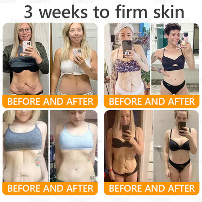 TGA Official: Daasry® Bee Venom Skin Restoration Cream - Anti-aging, Hydrating, Skin Firming & Lifting, Skin Repair, Even Tone, Acne and Dark Spot Treatment, Wart and Mole Removal, and Psoriasis Relief.