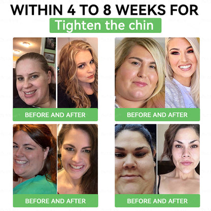 𝖮𝖿𝖿𝗂𝖼𝗂𝖺𝗅 𝖲𝗍𝗈𝗋𝖾 | 𝑩𝒖𝐢𝒍𝒅𝑳𝒆𝐚𝒇® GL𝐏-1 6-𝒊𝒏-1 𝑯𝒆𝒂𝒍𝒕𝒉 𝑺𝒐𝒍𝒖𝒕𝒊𝒐𝒏 𝖮𝗋𝖺𝗅 𝐋𝐢𝐪𝐮𝐢𝐝 (𝑱𝒖𝒔𝒕 𝒐𝒏𝒄𝒆 𝒂 𝒅𝒂𝒚, 𝘃𝗶𝘀𝗶𝗯𝗹𝗲 𝗰𝗵𝗮𝗻𝗴𝗲𝘀 𝗶𝗻 𝟳 𝗱𝗮𝘆𝘀） ✅ 𝘍𝘰𝘳 𝘰𝘣𝘦𝘴𝘪𝘵𝘺, 𝘤𝘢𝘳𝘥𝘪𝘰𝘷𝘢𝘴𝘤𝘶𝘭𝘢𝘳 𝘩𝘦𝘢𝘭𝘵𝘩,𝙙𝙞𝙖𝙗𝙚𝙩𝙚𝙨, 𝙨𝙡𝙚𝙚𝙥 𝐚𝐩𝐧𝐞𝐚, 𝐆𝐮𝐭 𝐇𝐞𝐚𝐥𝐭𝐡, 𝐣𝐨𝐢𝐧𝐭 𝐢𝐬𝐬𝐮𝐞𝐬, 𝐚𝐧𝐝 𝐦𝐨𝐫𝐞