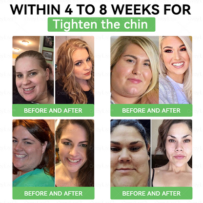 🇦🇺AU 𝑪𝒍𝒊𝒏𝒊𝒄𝒂𝒍𝒍𝒚 𝑷𝒓𝒐𝒗𝒆𝒏 | 𝑶𝒇𝒇𝒊𝒄𝒊𝒂𝒍 𝑺𝒕𝒐𝒓𝒆 | 𝐂𝒓𝓪𝙯𝙮𝐋𝑒𝑎𝐟® 𝚂𝖬𝐺𝘛-𝘎𝐿𝙋-1 𝑆𝘭𝘪𝘮 & 𝘝𝘪𝘵𝘢𝘭𝘪𝘵𝘺 𝖮𝗋𝖺𝗅 𝑆olution 𝗍𝖺𝗋𝗀𝖾𝗍𝗌 𝑡𝑢𝑏𝑏𝑜𝑟𝑛 𝑤𝑒𝑖𝑔ℎ𝑡, ℎ𝑖𝑔ℎ 𝑏𝑙𝑜𝑜𝑑 𝑝𝑟𝑒𝑠𝑠𝑢𝑟𝑒, 𝑏𝑙𝑜𝑜𝑑 𝑠𝑢𝑔𝑎𝑟 ,𝘧𝘢𝘵𝘵𝘺 𝘭𝘪𝘷𝘦𝘳, 𝘫𝘰𝘪𝘯𝘵 𝘱𝘢𝘪𝘯, 𝘧𝘢𝘵𝘪𝘨𝘶𝘦,𝑙𝑜𝑤 𝑒𝑛𝑒𝑟𝑔𝑦, 𝑠𝑎𝑔𝑔𝑖𝑛𝑔 𝑠𝑘𝑖𝑛 & 𝑚𝑜𝑟𝑒 𝑓𝑜𝑟 𝑏𝑒𝑡𝑡𝑒𝑟 ℎ𝑒𝑎𝑙𝑡ℎ & 𝑣𝑖𝑡𝑎𝑙𝑖𝑡𝑦