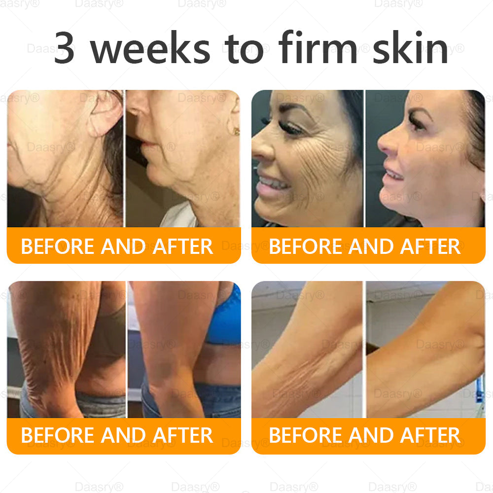 TGA Official: Daasry® Bee Venom Skin Restoration Cream - Anti-aging, Hydrating, Skin Firming & Lifting, Skin Repair, Even Tone, Acne and Dark Spot Treatment, Wart and Mole Removal, and Psoriasis Relief.