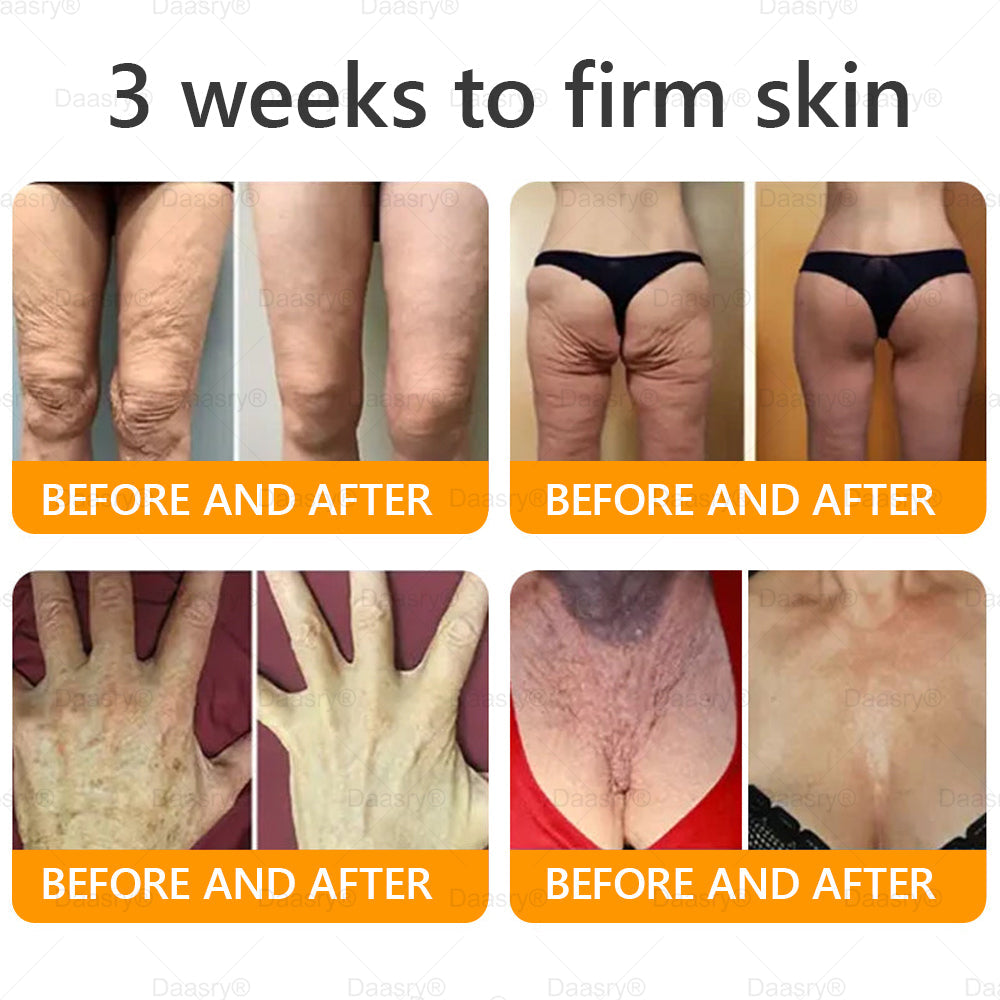 TGA Official: Daasry® Bee Venom Skin Restoration Cream - Anti-aging, Hydrating, Skin Firming & Lifting, Skin Repair, Even Tone, Acne and Dark Spot Treatment, Wart and Mole Removal, and Psoriasis Relief.