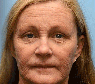 PUROSA®--One last chance! Grab this lucky find at 50% OFF!🔥180-day money back guarantee! Free air shipping!