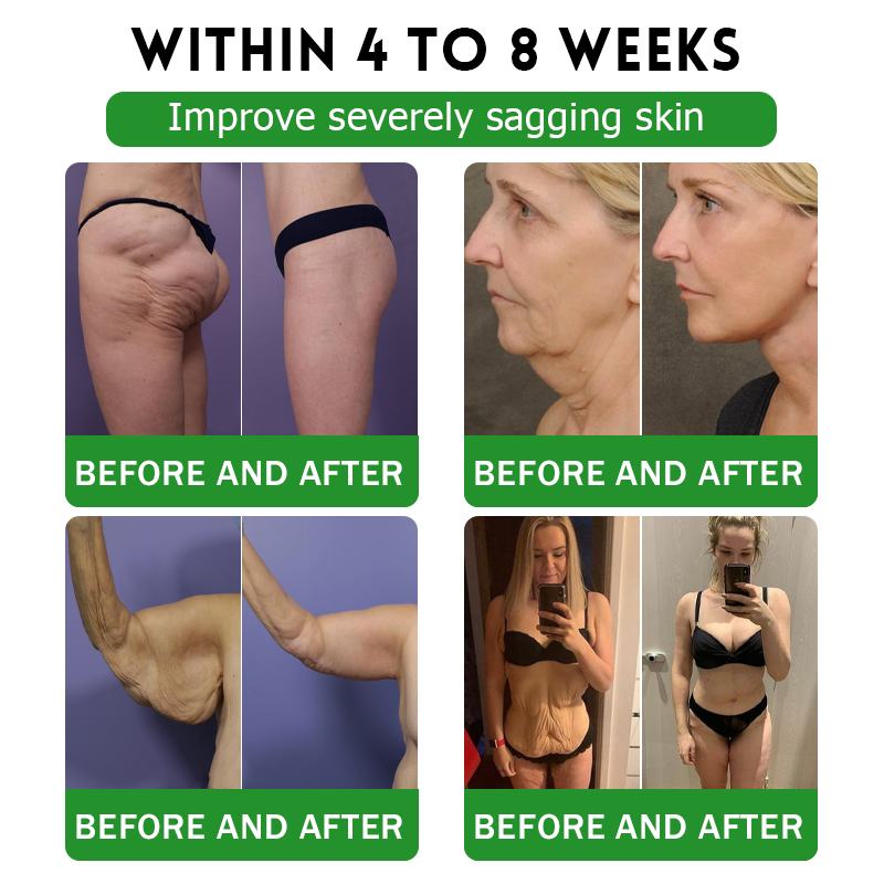 AU 𝖮𝖿𝖿𝗂𝖼𝗂𝖺𝗅 𝖲𝗍𝗈𝗋𝖾 | 𝑩𝒖𝐢𝒍𝒅𝑳𝒆𝐚𝒇® GL𝐏-1 6-𝒊𝒏-1 𝑯𝒆𝒂𝒍𝒕𝒉 𝑺𝒐𝒍𝒖𝒕𝒊𝒐𝒏 𝖮𝗋𝖺𝗅 𝐋𝐢𝐪𝐮𝐢𝐝 (𝑱𝒖𝒔𝒕 𝒐𝒏𝒄𝒆 𝒂 𝒅𝒂𝒚, 𝘃𝗶𝘀𝗶𝗯𝗹𝗲 𝗰𝗵𝗮𝗻𝗴𝗲𝘀 𝗶𝗻 𝟳 𝗱𝗮𝘆𝘀） ✅ 𝘍𝘰𝘳 𝘰𝘣𝘦𝘴𝘪𝘵𝘺, 𝘤𝘢𝘳𝘥𝘪𝘰𝘷𝘢𝘴𝘤𝘶𝘭𝘢𝘳 𝘩𝘦𝘢𝘭𝘵𝘩,𝙙𝙞𝙖𝙗𝙚𝙩𝙚𝙨, 𝙨𝙡𝙚𝙚𝙥 𝐚𝐩𝐧𝐞𝐚, 𝐆𝐮𝐭 𝐇𝐞𝐚𝐥𝐭𝐡, 𝐣𝐨𝐢𝐧𝐭 𝐢𝐬𝐬𝐮𝐞𝐬, 𝐚𝐧𝐝 𝐦𝐨𝐫𝐞