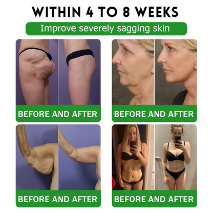 AU 𝖮𝖿𝖿𝗂𝖼𝗂𝖺𝗅 𝖲𝗍𝗈𝗋𝖾 | 𝑩𝒖𝐢𝒍𝒅𝑳𝒆𝐚𝒇® GL𝐏-1 6-𝒊𝒏-1 𝑯𝒆𝒂𝒍𝒕𝒉 𝑺𝒐𝒍𝒖𝒕𝒊𝒐𝒏 𝖮𝗋𝖺𝗅 𝐋𝐢𝐪𝐮𝐢𝐝 (𝑱𝒖𝒔𝒕 𝒐𝒏𝒄𝒆 𝒂 𝒅𝒂𝒚, 𝘃𝗶𝘀𝗶𝗯𝗹𝗲 𝗰𝗵𝗮𝗻𝗴𝗲𝘀 𝗶𝗻 𝟳 𝗱𝗮𝘆𝘀） ✅ 𝘍𝘰𝘳 𝘰𝘣𝘦𝘴𝘪𝘵𝘺, 𝘤𝘢𝘳𝘥𝘪𝘰𝘷𝘢𝘴𝘤𝘶𝘭𝘢𝘳 𝘩𝘦𝘢𝘭𝘵𝘩,𝙙𝙞𝙖𝙗𝙚𝙩𝙚𝙨, 𝙨𝙡𝙚𝙚𝙥 𝐚𝐩𝐧𝐞𝐚, 𝐆𝐮𝐭 𝐇𝐞𝐚𝐥𝐭𝐡, 𝐣𝐨𝐢𝐧𝐭 𝐢𝐬𝐬𝐮𝐞𝐬, 𝐚𝐧𝐝 𝐦𝐨𝐫𝐞